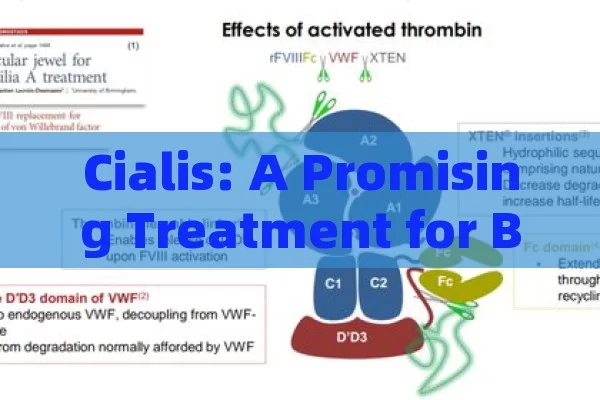 Cialis: A Promising Treatment for BPH,Title: Cialis for BPH Relief